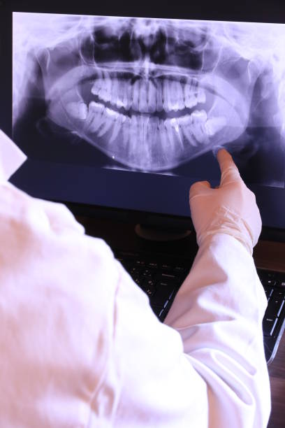 Best Emergency Broken Tooth Repair in Lyons, NJ